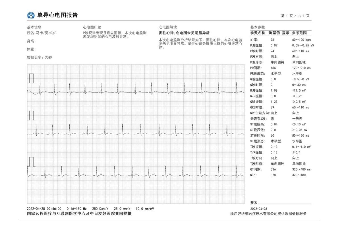 华为 WATCH GT 3 Pro 评测：全网最懂你健康的表