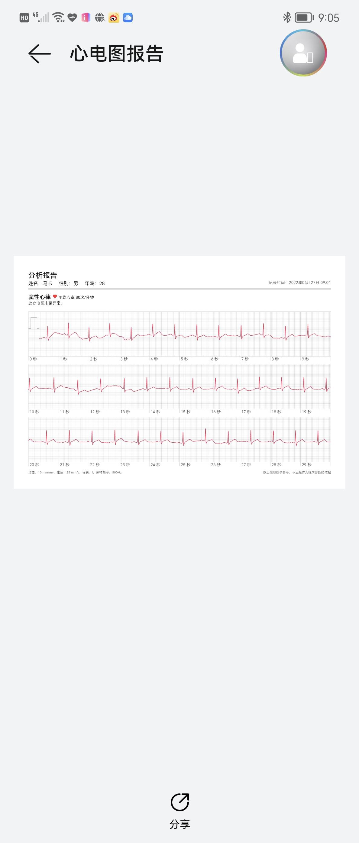 华为 WATCH GT 3 Pro 评测：全网最懂你健康的表